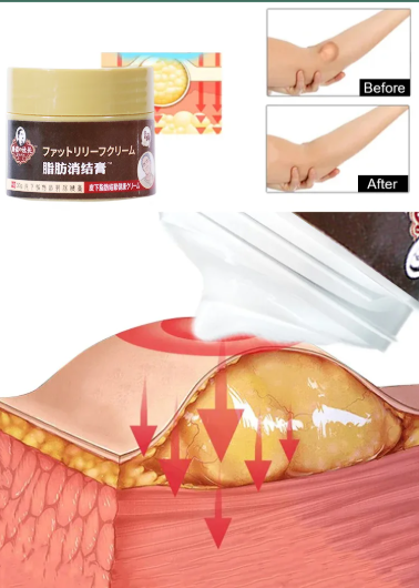 Японський крем для видалення жировиків і зменшення лімфовузлів